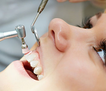 Dental Cleanings & Exams in Fresno CA