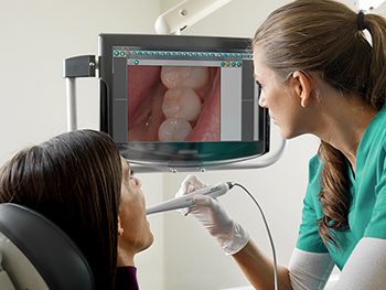 Intraoral Cameras in dentistry
