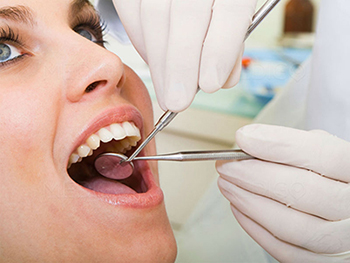 Tooth Extraction in Fresno CA